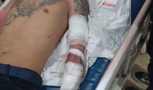 Polres Serang Kota, Selidiki Kasus Pembacokan Di Pasar Rau