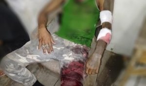 Niat Minta Maaf, Kusni Malah Dibacok