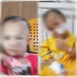 MRI Ucapkan Syukur, Balita yang Menderita Tumor Telah Berhasil Dioperasi