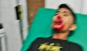 Keasyikan Duduk Mabar Tiba Dua Remaja Diparangi OTK