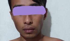 Lelaki Dots Diringkus Polisi di Pantai Pantera