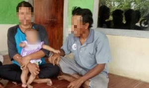 Lahir Tanpa Anus, Bayi Usia 6 Bulan di Bekasi Butuh Uluran Tangan