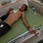 Putra Agustinus Pasaribu Warga Simalungun Luka-luka Ditikam Pengamen Jalanan
