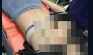 Istri Tewas Dibunuh Suaminya, Pisau Masih Menancap