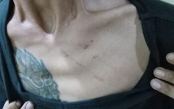 Pedagang Gudeg Lapor ke Polisi, Enas Minta Kronologi Sebenarnya Dibuka