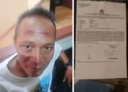 Bantu Mediasi Kasus Kecelakaan, Pimpinan Redaksi BantenNet Diduga Dianiaya di Serpong