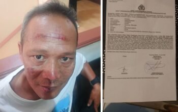 Bantu Mediasi Kasus Kecelakaan, Pimpinan Redaksi BantenNet Diduga Dianiaya di Serpong