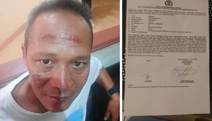Bantu Mediasi Kasus Kecelakaan, Pimpinan Redaksi BantenNet Diduga Dianiaya di Serpong